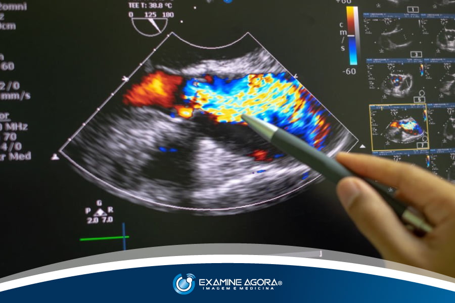 A Importância Do Exame De Ultrassonografia Vascular Com Doppler Colorido Examine Agora 